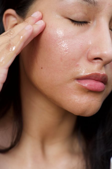 How to Get Rid of Oily Skin?