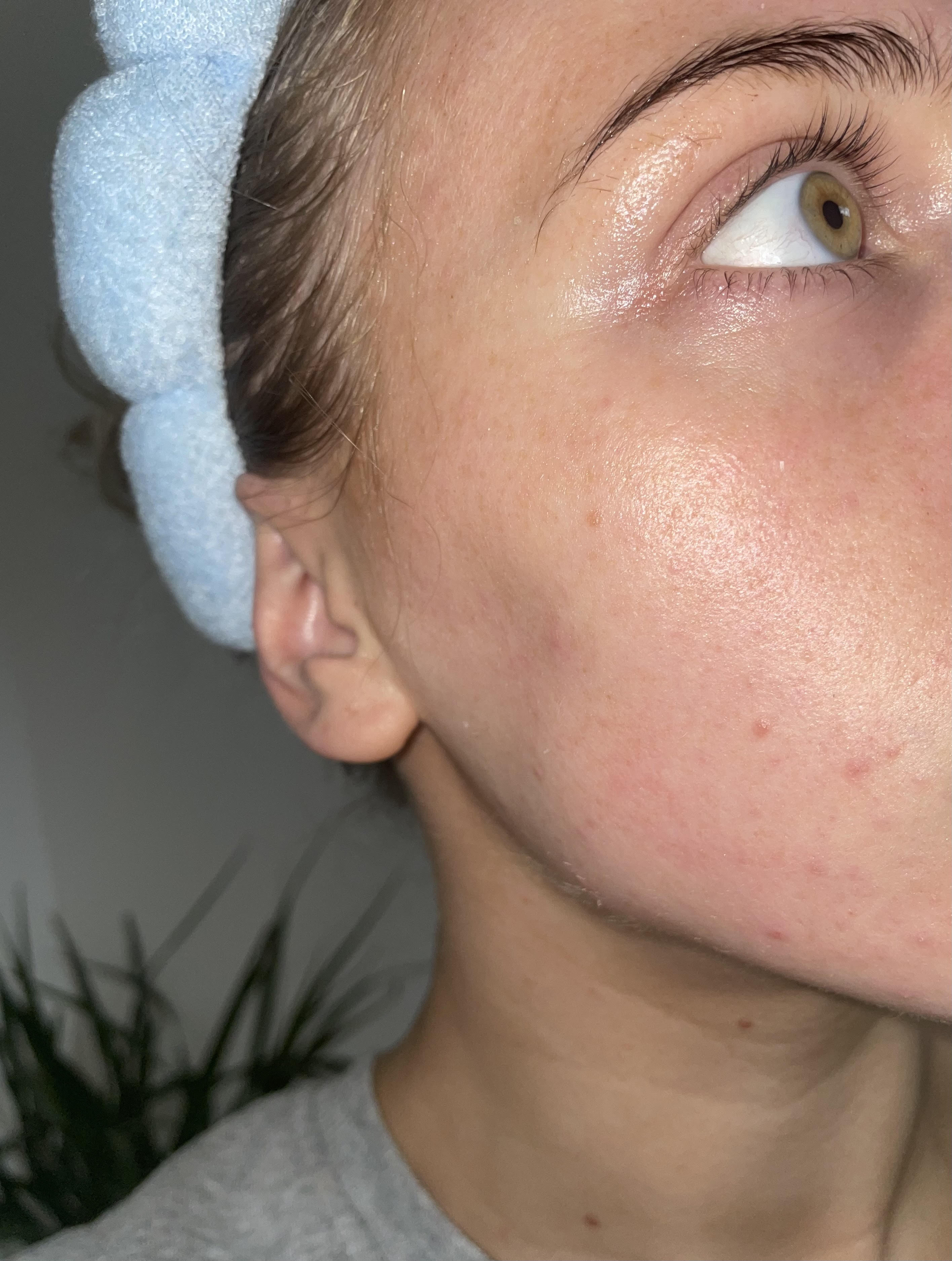 is Your Skin Aging Faster Than You’d Like? Fix It Now!