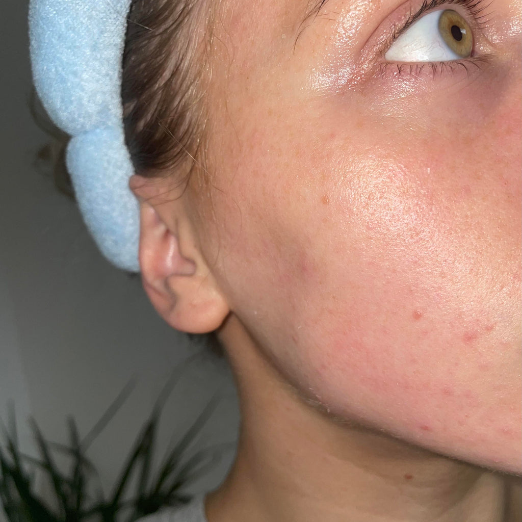 is Your Skin Aging Faster Than You’d Like? Fix It Now!