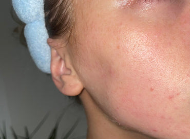is Your Skin Aging Faster Than You’d Like? Fix It Now!